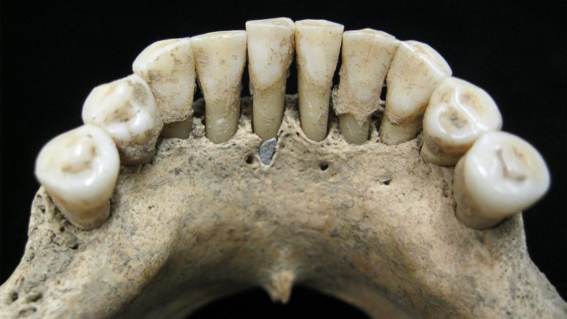 Medieval Painter s Teeth Reveal Lapis Lazuli Pigment