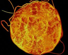 Discover the Energy Superbugs: Extremophiles Thriving in Extreme Environments