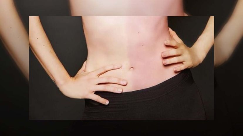 Chimerism Explained: How One Person Can Carry Two Distinct DNA Sets