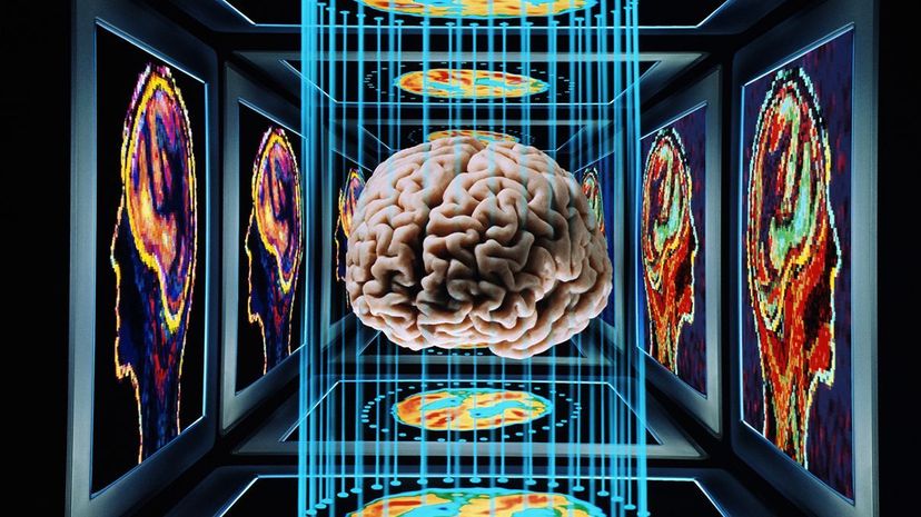 Scientists Make Strides Toward Erasing Painful Memories