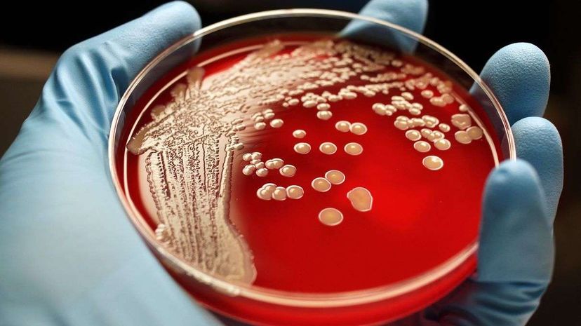 Explore How Bacteria Transform into Drug-Resistant Superbugs