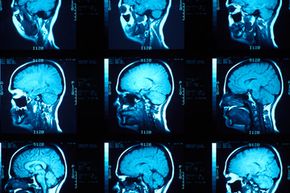 Can Brain Scans Predict Criminal Tendencies?