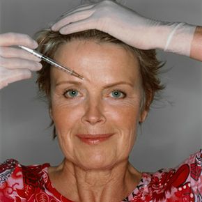 Does Botox Improve Mood by Erasing the Frown?