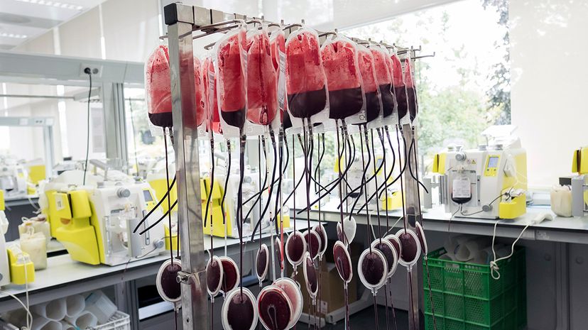 Can Young Blood Transfusions Slow Aging? A Scientific Review