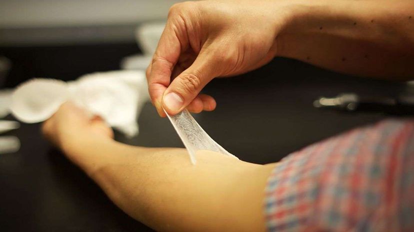 Revolutionary  Second Skin  Technology: Diverse Applications Explained