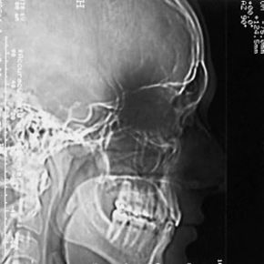 How CAT Scans Work: A Clear, Professional Explanation