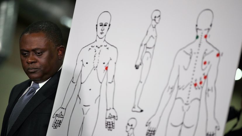 Five Surprising Facts About Autopsy Procedures