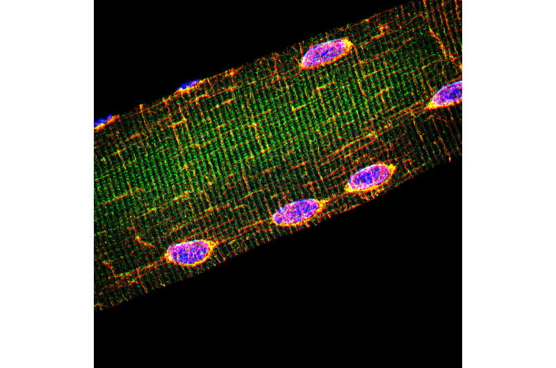 Researchers Uncover the Cellular Mechanism That Positions Nuclei Within Muscle Cells