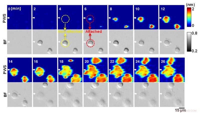 Revolutionizing Diagnostics: Photonic Crystal Microscope Illuminates Wound Healing and Cancer Metastasis