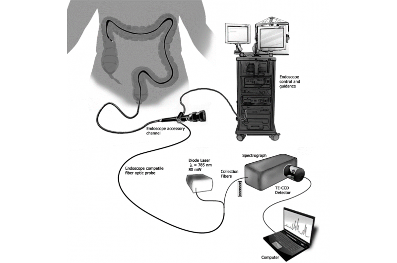 Revolutionary Sensor Detects Inflammatory Bowel Disease During Routine Colonoscopies