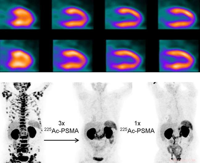 Advanced Production of Radioisotopes for Medical Imaging and Therapy