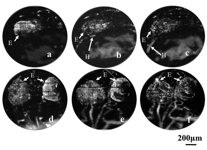 Live Imaging Reveals Vascular Development in Whole Zebrafish Embryos
