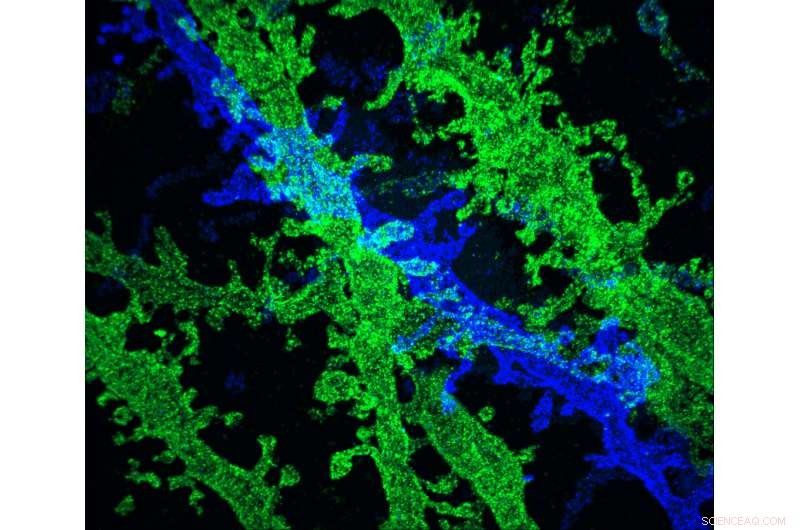 Ultra‑High‑Resolution Imaging Using Standard Microscopes