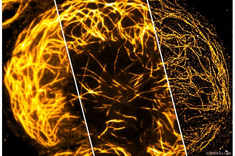 Chip-Based Nanoscopy: Achieving HD-Quality Microscopy