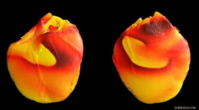 Scientists Discover Novel Cause of Life-Threatening Cardiac Electrical Instability
