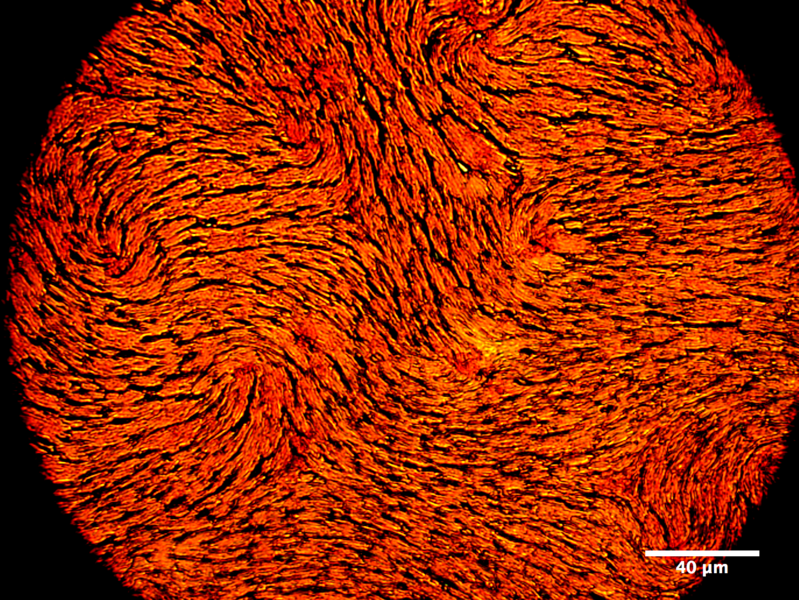 New Study Reveals How Drying Liquid Crystal Droplets Form Unusual Coffee Rings