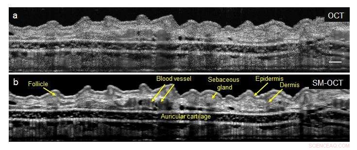 Scientists Accelerate High-Resolution 3‑D Imaging with Advanced Optical Coherence Tomography