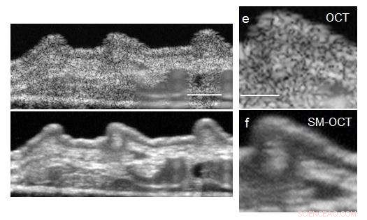 Scientists Accelerate High-Resolution 3‑D Imaging with Advanced Optical Coherence Tomography