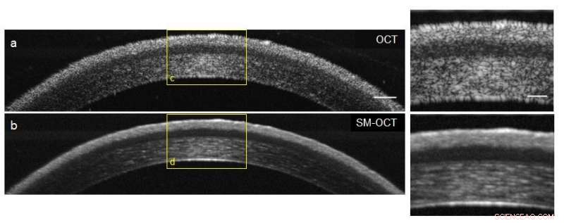Scientists Accelerate High-Resolution 3‑D Imaging with Advanced Optical Coherence Tomography