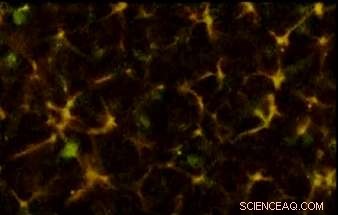 New Optical Clearing Technique Enables 3D Insight into Life‑Threatening Blood Clots