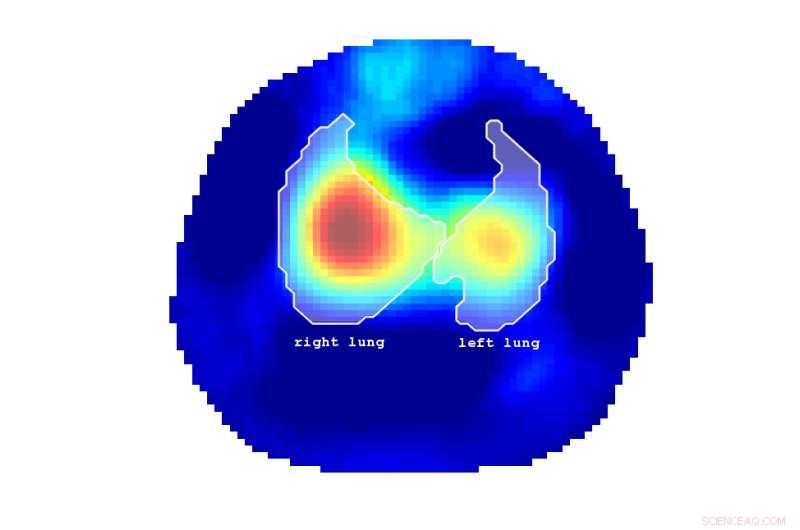 Electrical Impedance Tomography: A New Window into Lung Function