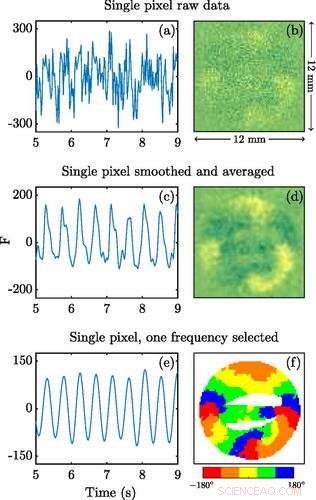Advanced Mapping of Arrhythmia-Related Excitations