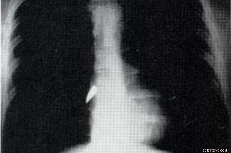 Marie Curie s Mobile X-ray Units: Pioneering Battlefield Medicine in World War I