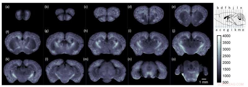 Revolutionary Imaging Technique Charts Global Brain Alterations in Alzheimer’s Mouse Models