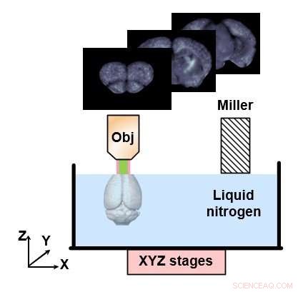 Revolutionary Imaging Technique Charts Global Brain Alterations in Alzheimer’s Mouse Models