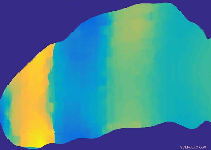 Why Some Head Injuries Cause Greater Brain Damage