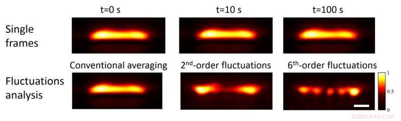 Super‑Resolution Photoacoustic Imaging Enables High‑Definition Observation of Blood Vessels