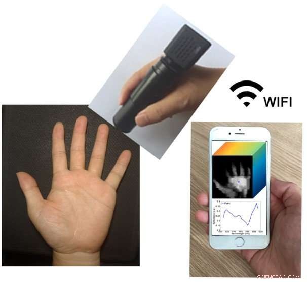 Pencil‑Shaped Wireless Spectrometer Streams 3‑D Spectral Images to Smartphones for Point‑of‑Care Diagnostics