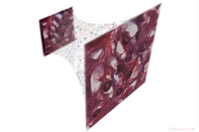 UCLA Researchers Leverage Deep Learning to Reconstruct Holograms, Enhancing Optical Microscopy