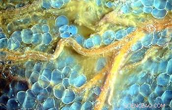 UV‑Illuminated Microscopy: A New Diagnostic Tool in Pathology