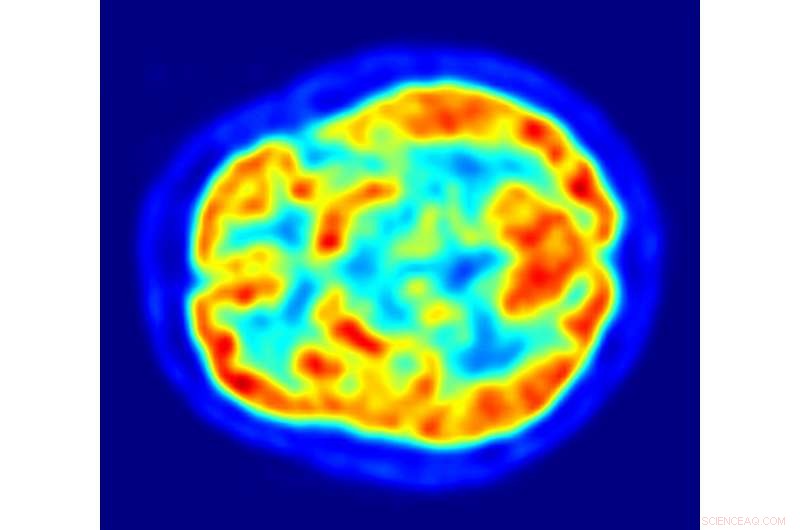 Exploring Particle Physics in the Human Brain