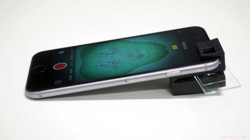 Clip‑On Device Transforms Smartphones into Full‑Functioning Microscopes