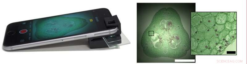 Clip‑On Device Transforms Smartphones into Full‑Functioning Microscopes