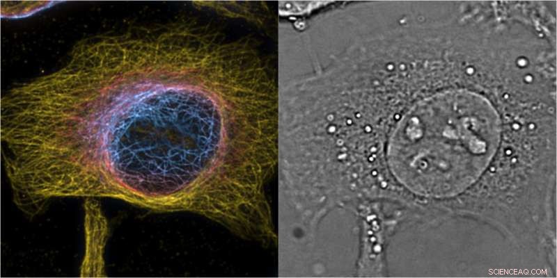 Enhancing Space and Time Resolution with Advanced Super‑Resolution Microscopy