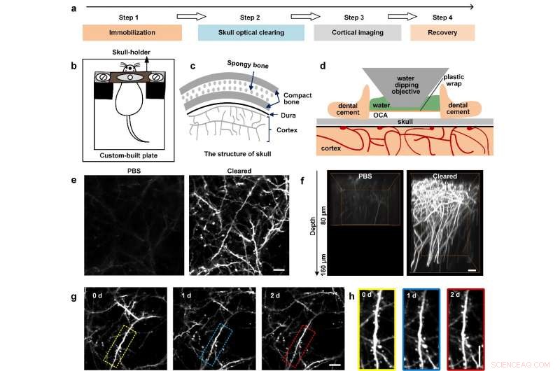 Noninvasive Skull Optical Clearing Window Enhances Cortical Imaging
