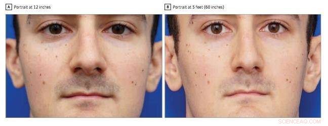 How Close‑Up Selfies Distort Your Nose: Insights from Rutgers Researchers