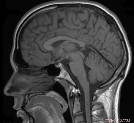 Pushing MRI to Micrometer Resolution: Revolutionizing Biomedical Imaging