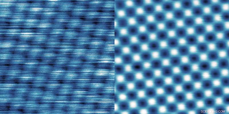 Optimized Suspension System Enhances Image Precision in High-Performance Microscopy