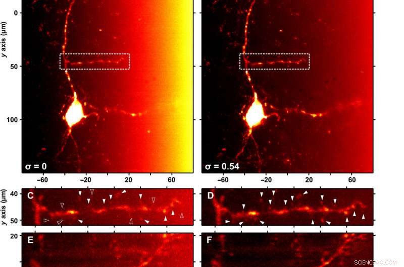 Innovative Light-Based Imaging Promises Less Invasive, More Accurate Patient Diagnosis