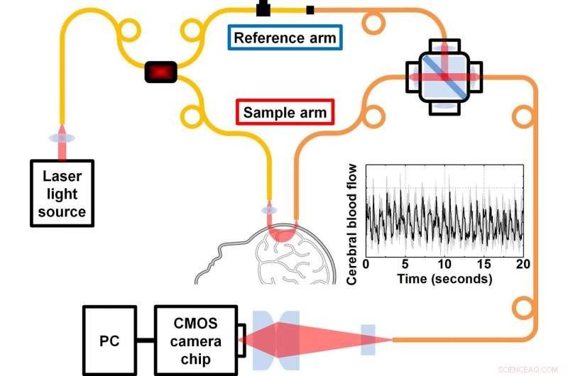 Innovative Light-Based Technique Offers Accurate Brain Blood Flow Measurement