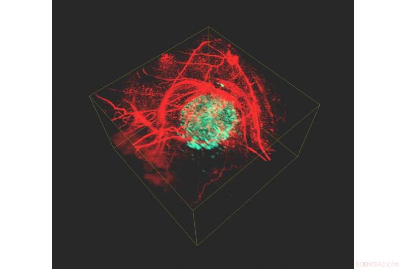 Physicists Develop Advanced 3‑D Imaging Method to Visualize Cancer Cells Inside the Body