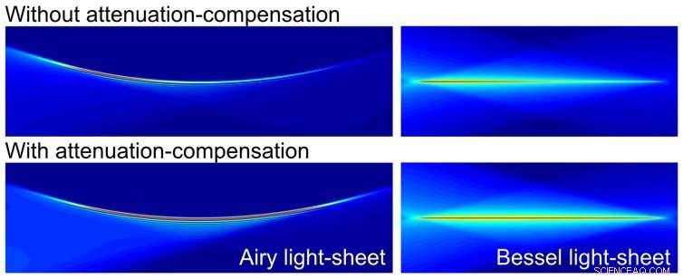 Advanced Bendy Laser Beams Revolutionize Human Tissue Examination