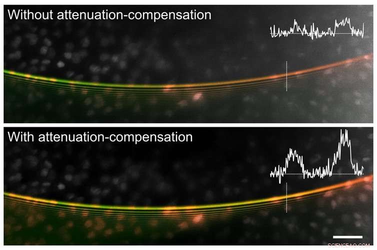 Advanced Bendy Laser Beams Revolutionize Human Tissue Examination