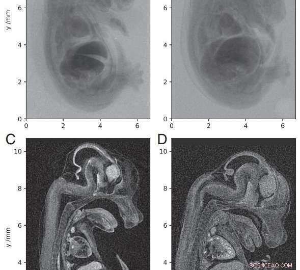 Groundbreaking Micro‑CT Imaging Achieves Unprecedented Resolution of Mouse Embryo