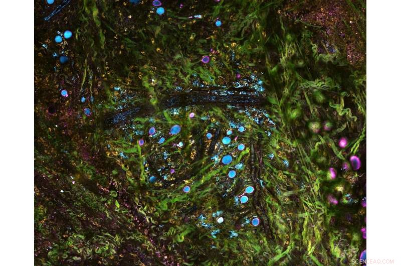 Revolutionary Real‑Time Tissue Imaging Offers Precise Cancer Diagnostics and Progression Mapping