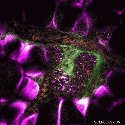 Revolutionary Real‑Time Tissue Imaging Offers Precise Cancer Diagnostics and Progression Mapping